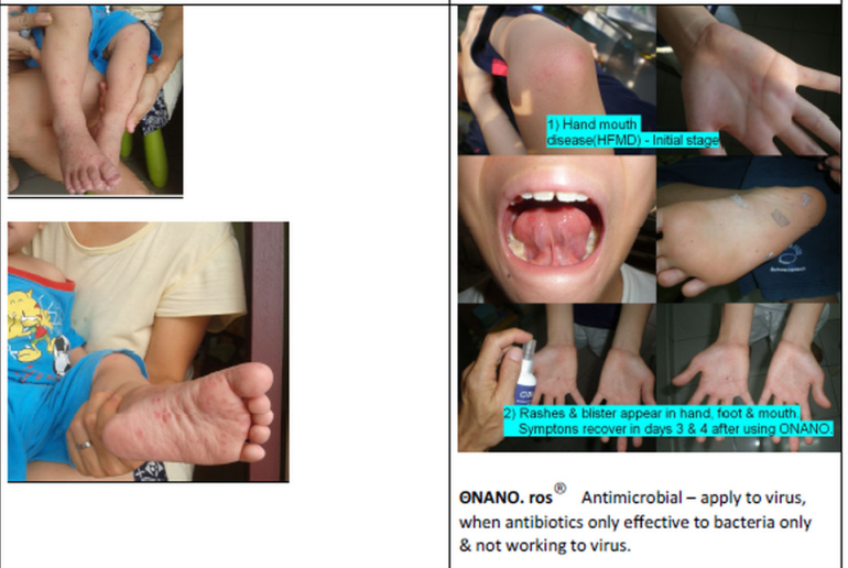 ONANOros Hygiene Antibacterial Spray (60ml), Personal care hygiene, Intimate hygiene